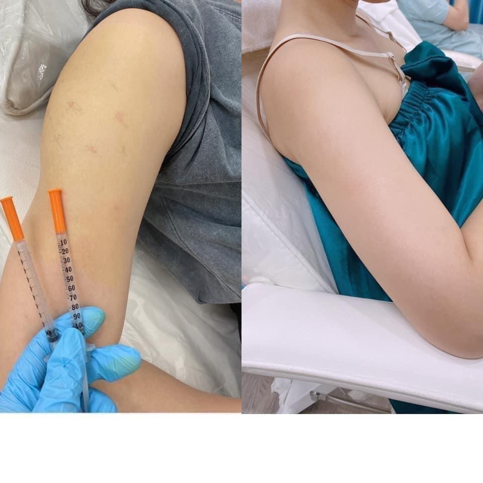 Nguyen Hai Dang | Founder &amp; Treatment Practitioner — DIVA Skin Clinic Poipet