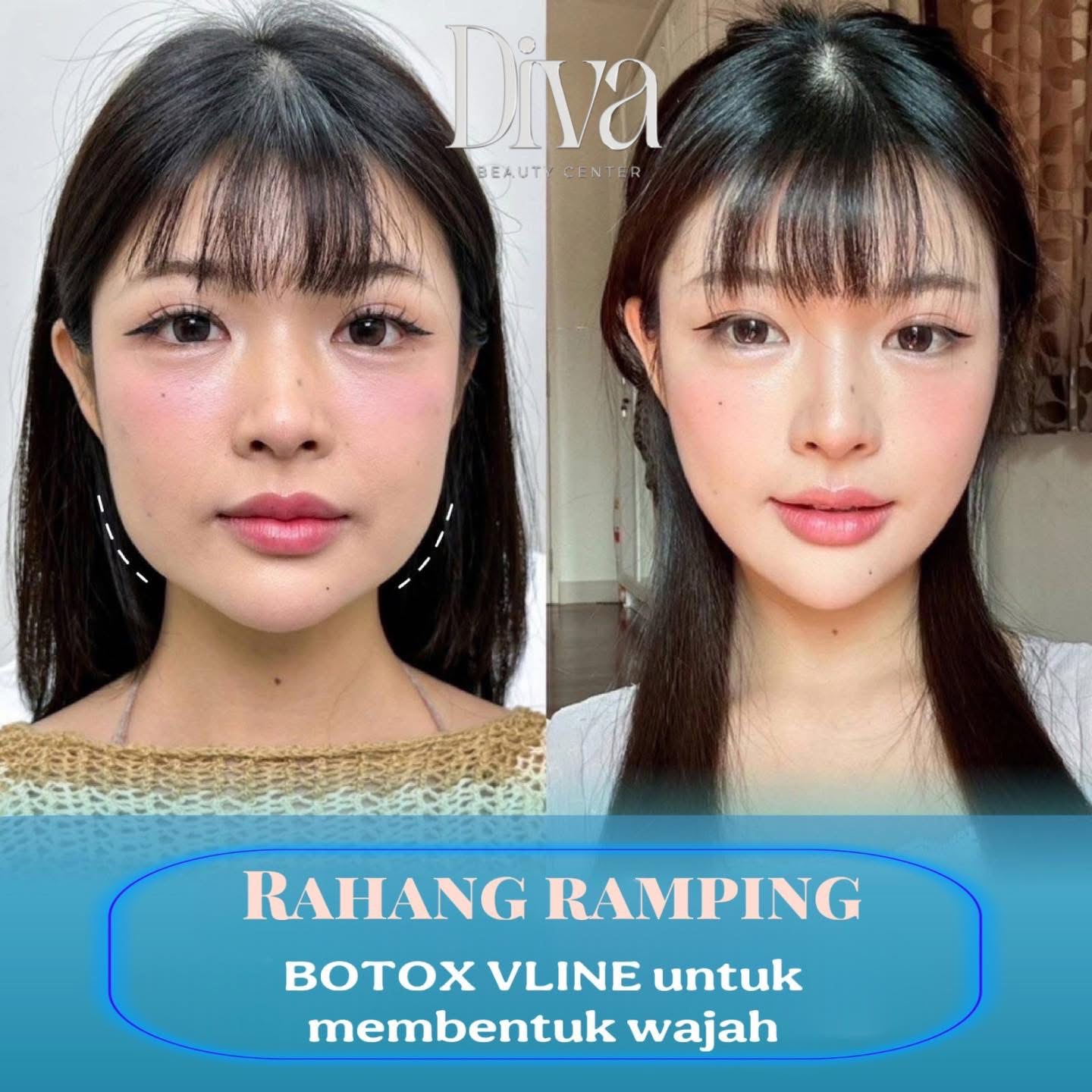 What Are Foundation Products, Treatment Products, and Support Products? — DIVA Skin Clinic Poipet