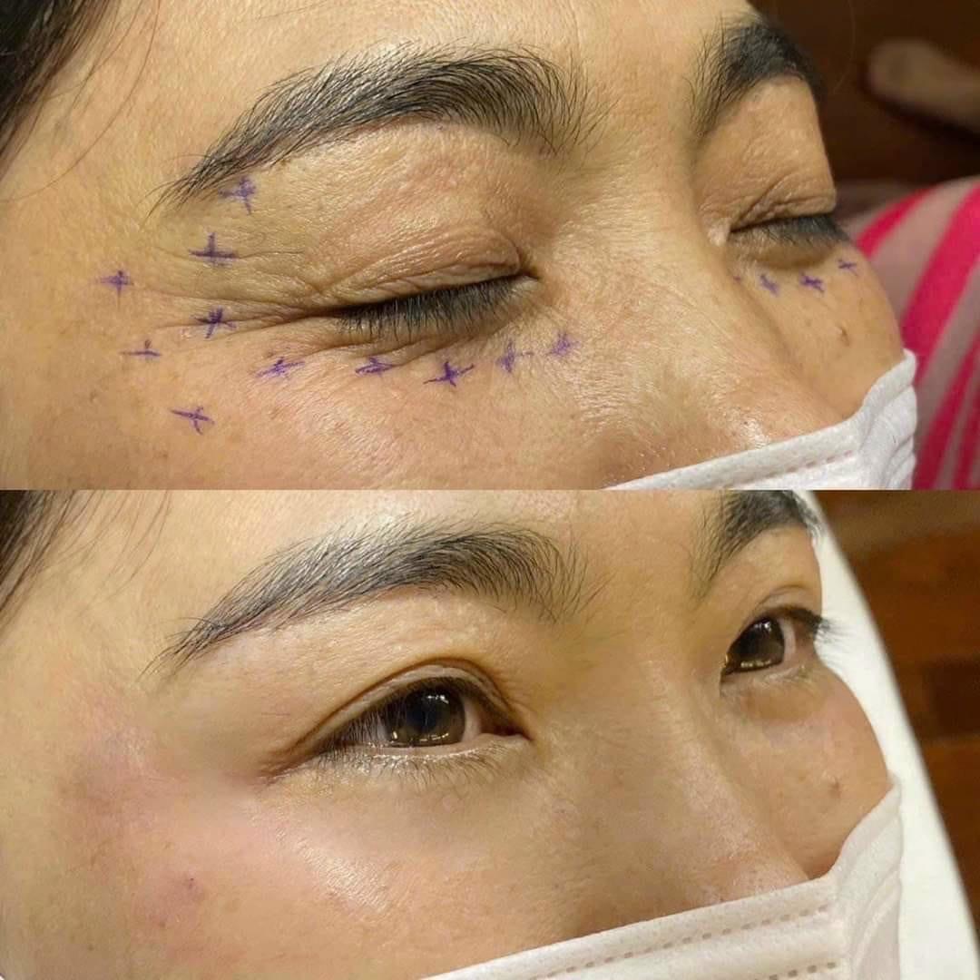 Clinic and Facility image 4 at DIVA Skin Clinic Poipet