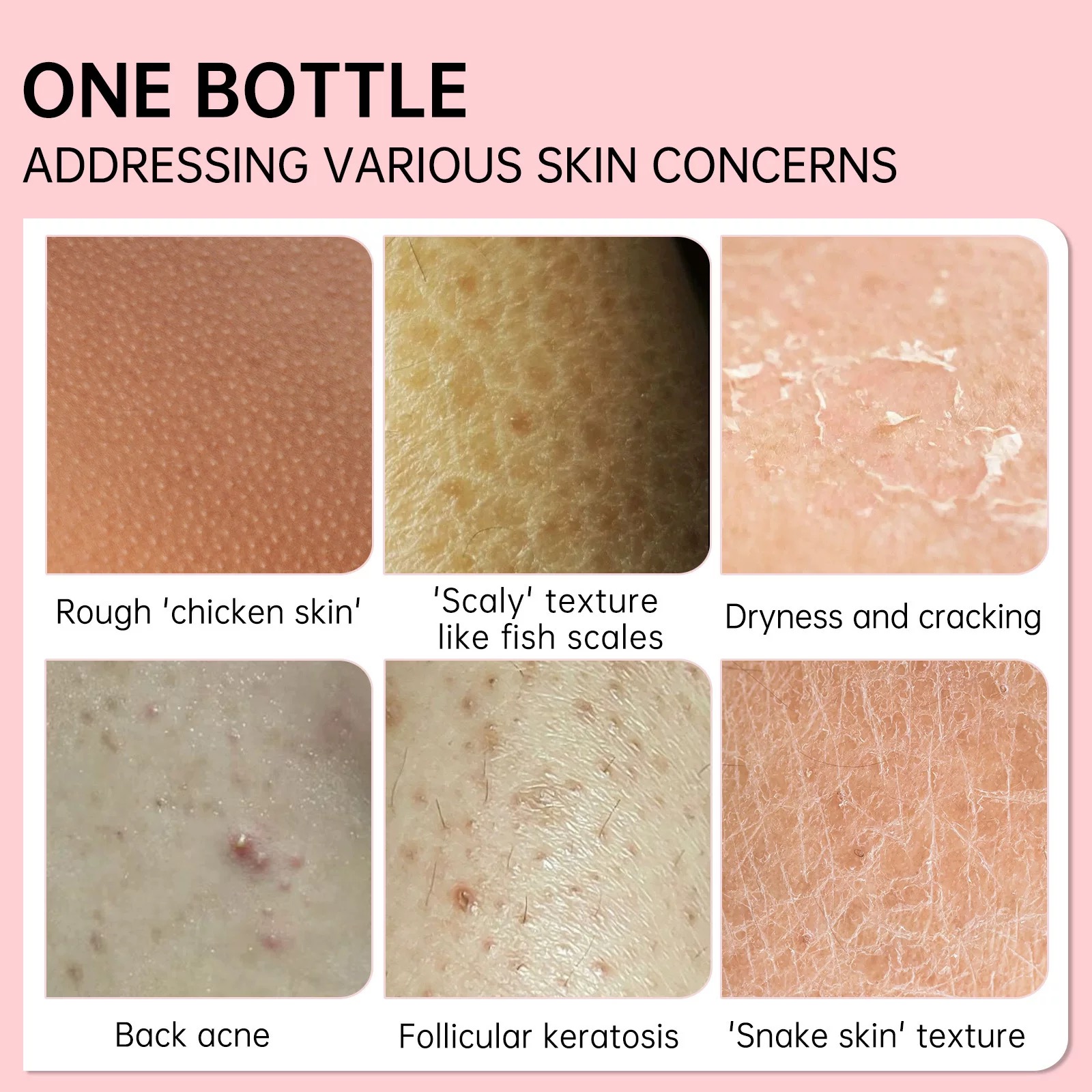 Body and Intimate Treatment image 7 at DIVA Skin Clinic Poipet