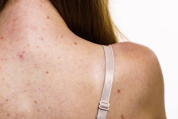 Skin Concerns & Root Causes