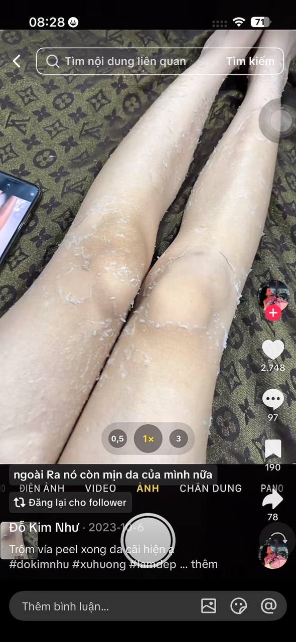 Body and Intimate Treatment image 11 at DIVA Skin Clinic Poipet