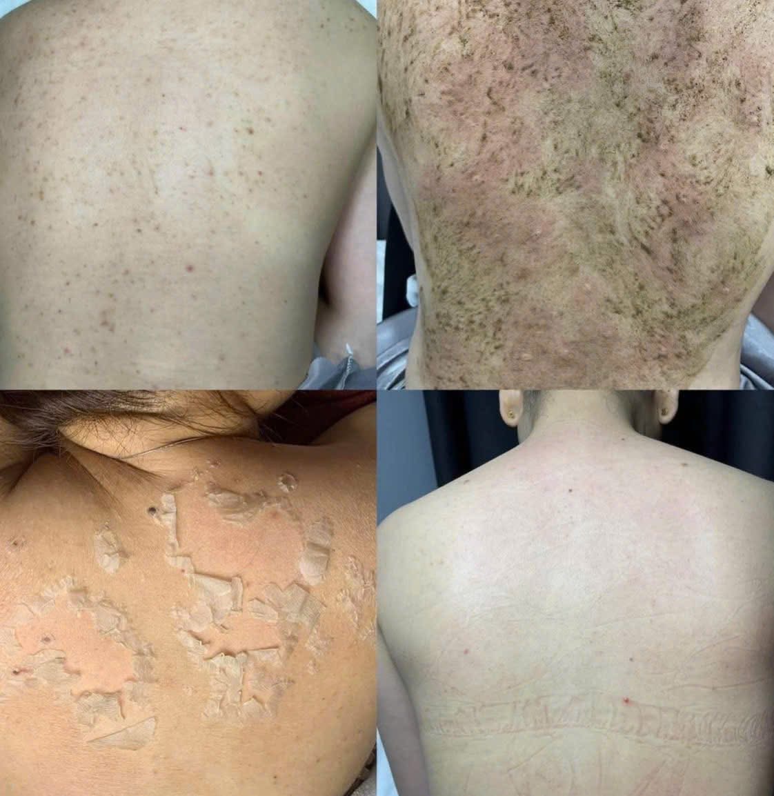 Treatment Case Studies