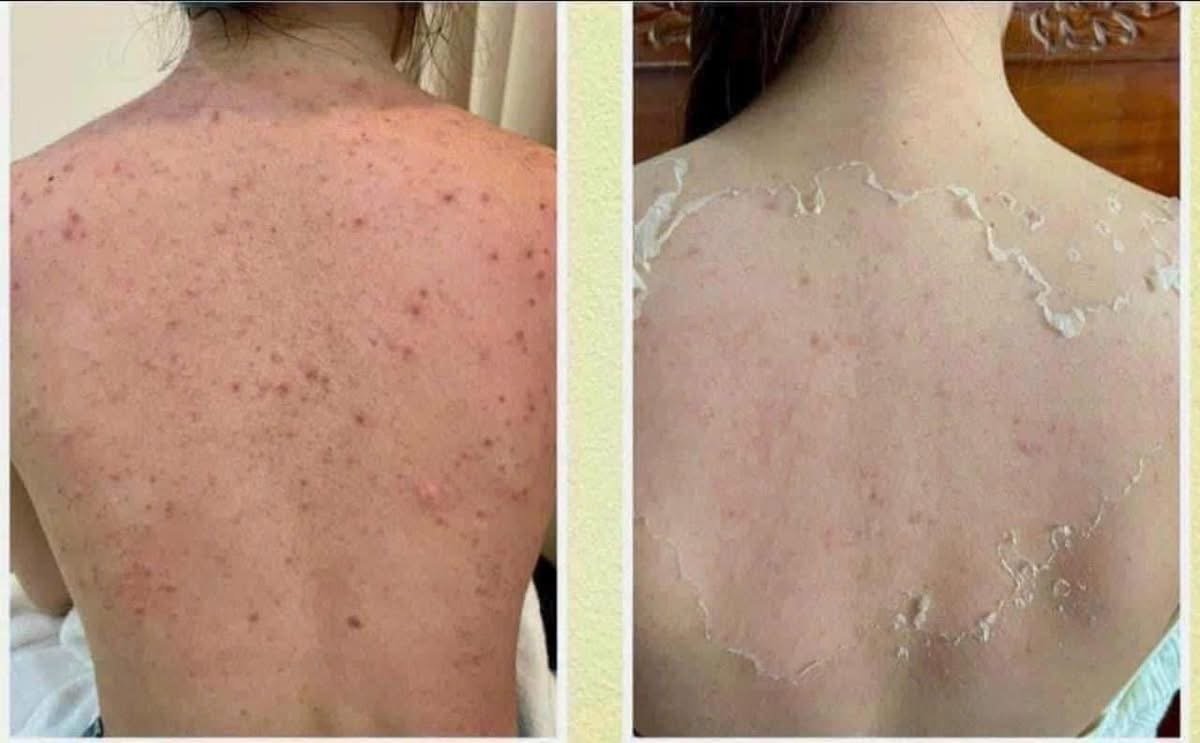 Body & Intimate Treatment in Poipet — image 6