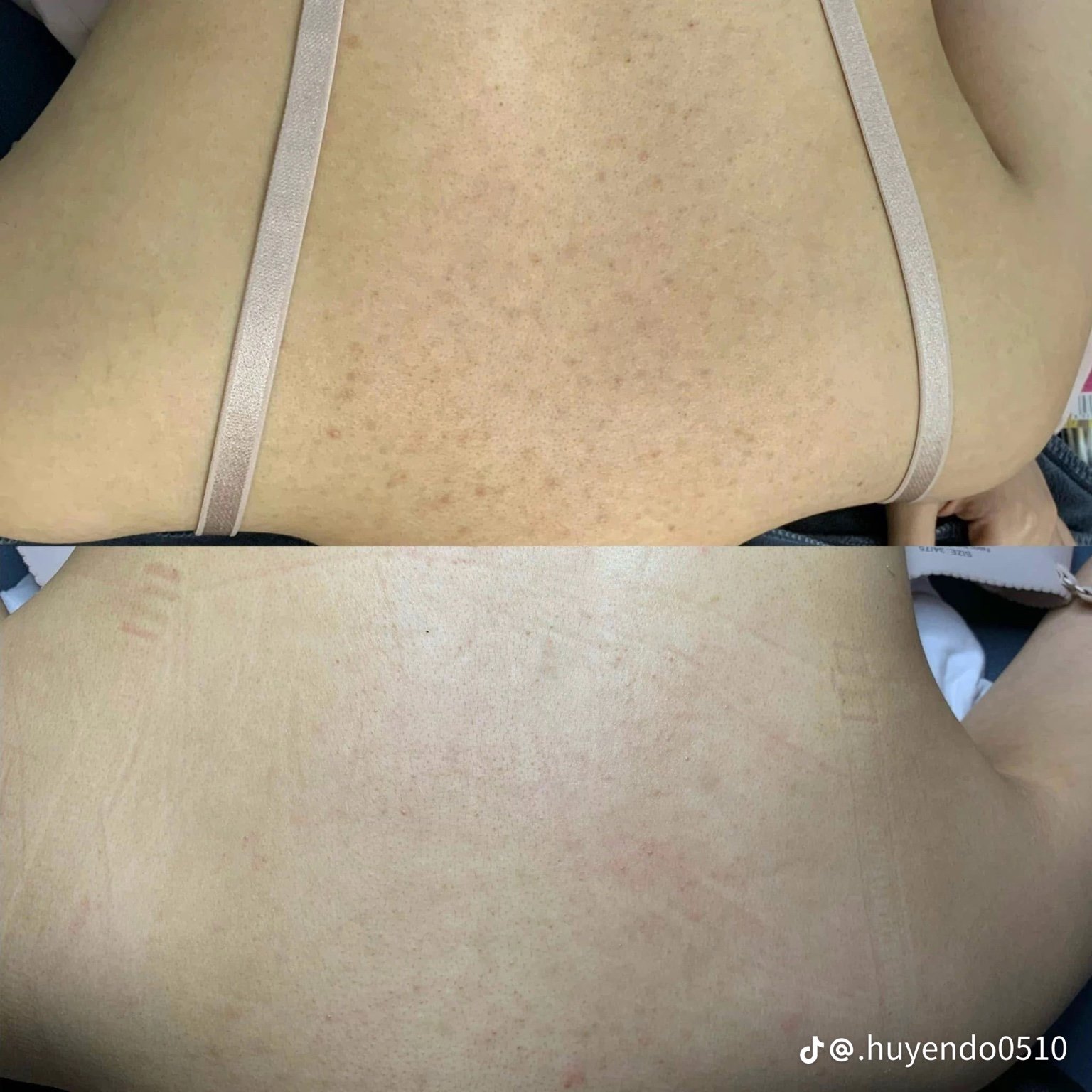 Body & Intimate Treatment in Poipet — image 8