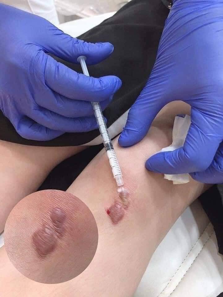 Body and Intimate Treatment image 20 at DIVA Skin Clinic Poipet