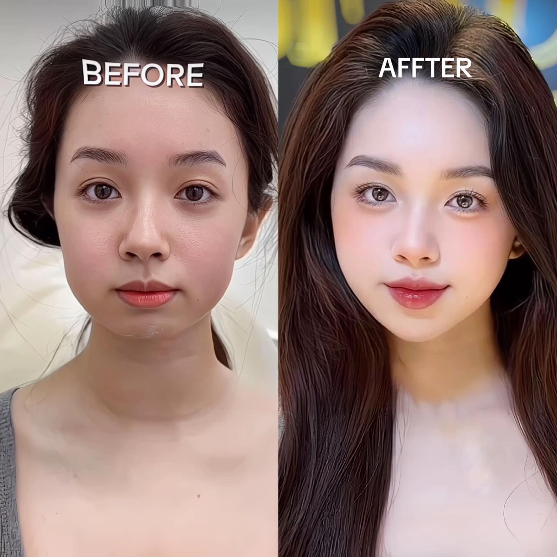 Skin Treatment image 37 at DIVA Skin Clinic Poipet