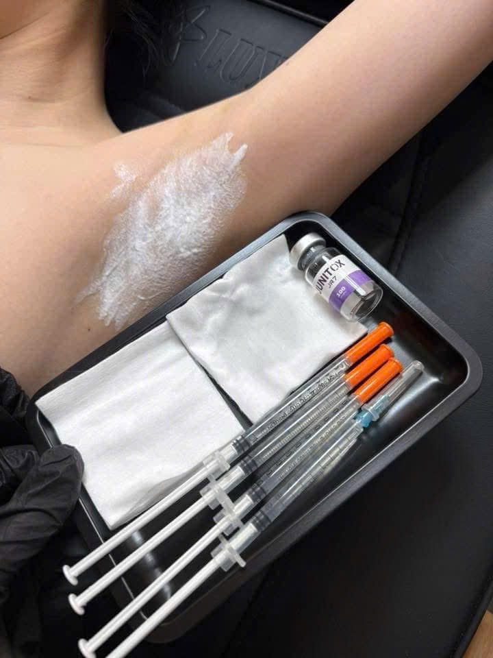 After Botox