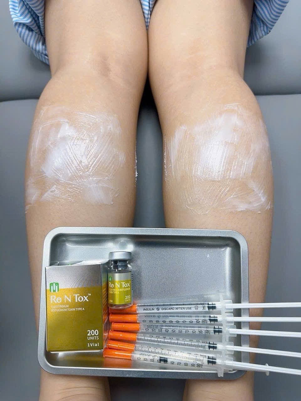 Botox Treatment image 18 at DIVA Skin Clinic Poipet