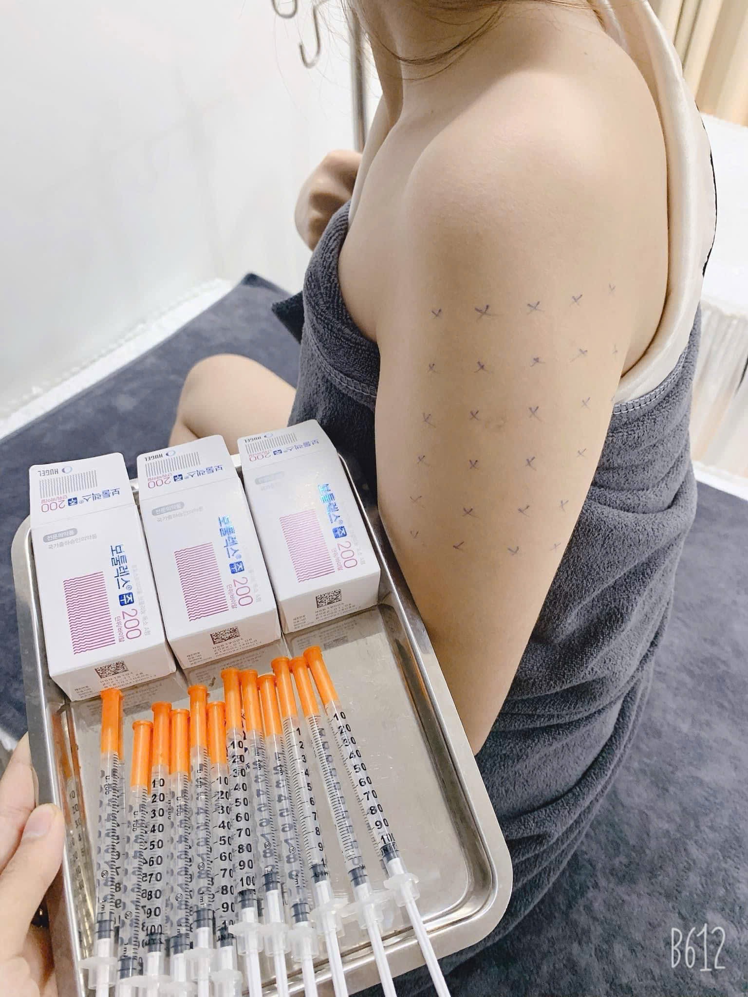 Botox Treatment image 20 at DIVA Skin Clinic Poipet