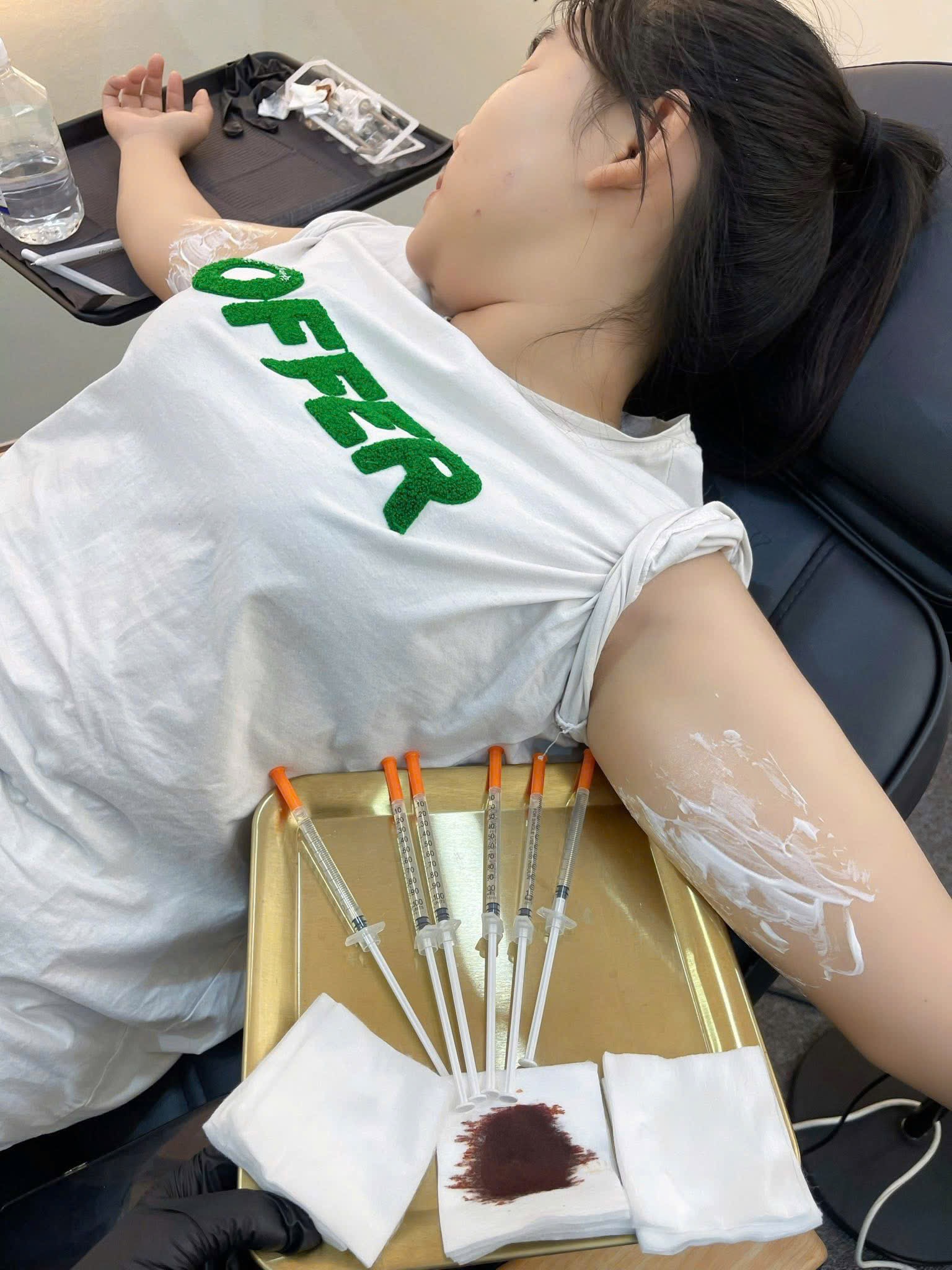 Botox Treatment image 21 at DIVA Skin Clinic Poipet