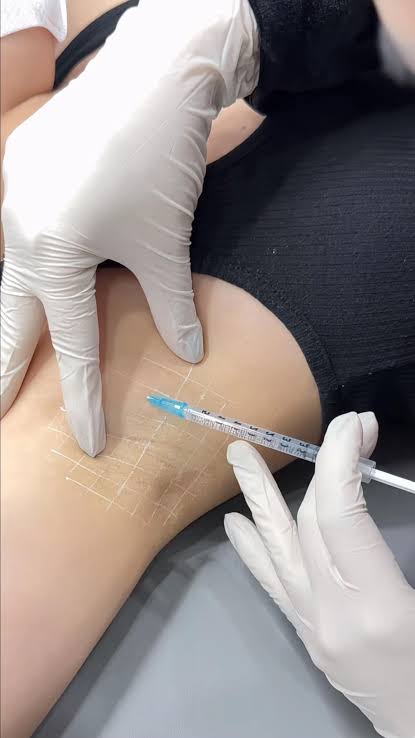 Botox Treatment image 24 at DIVA Skin Clinic Poipet