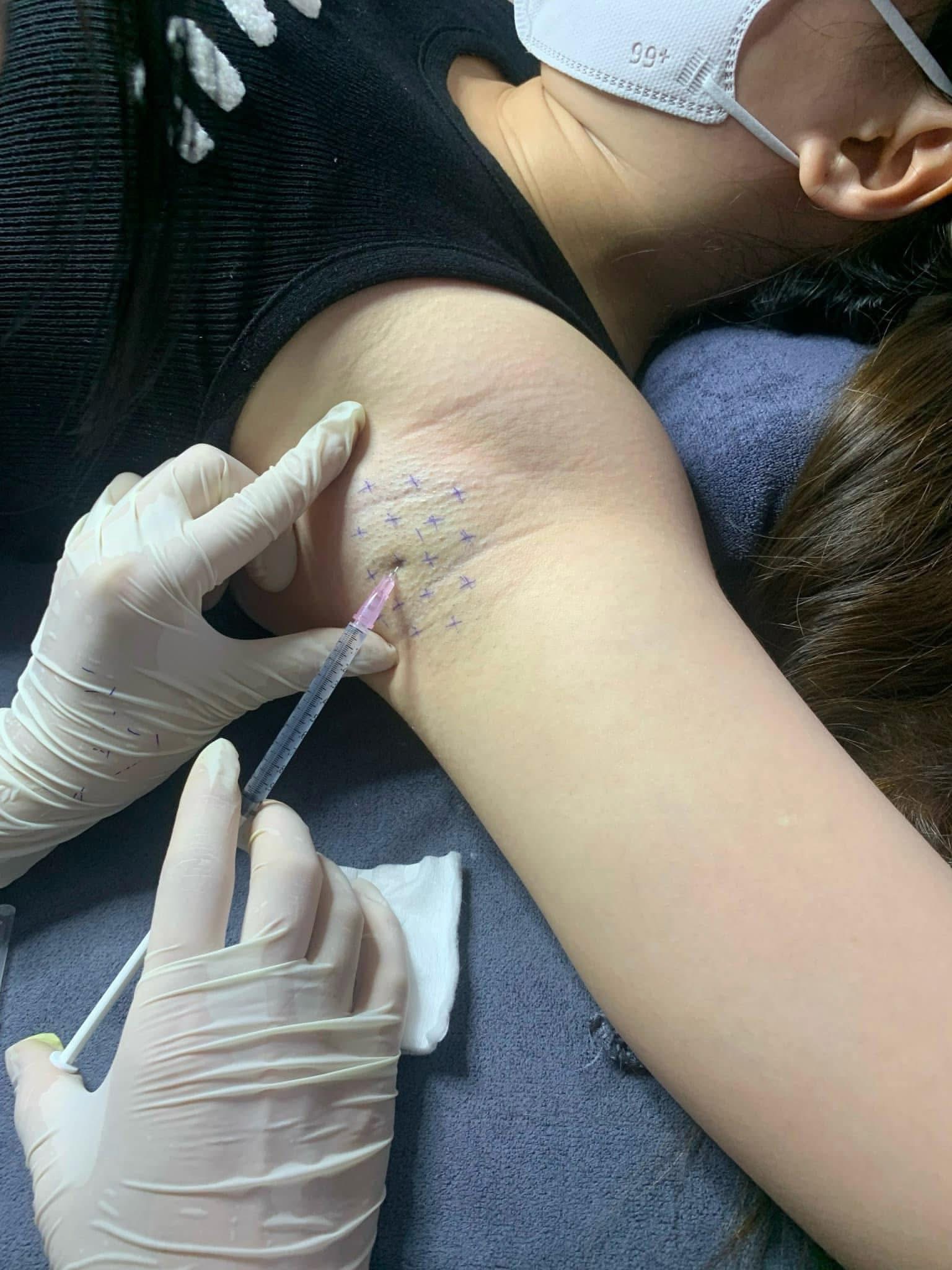 Botox Treatment image 25 at DIVA Skin Clinic Poipet
