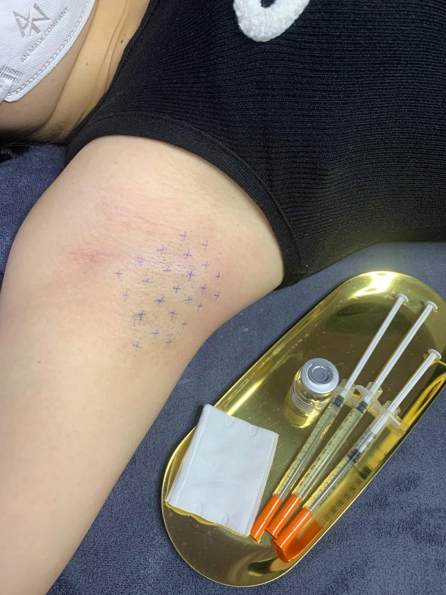 Botox Treatment image 26 at DIVA Skin Clinic Poipet