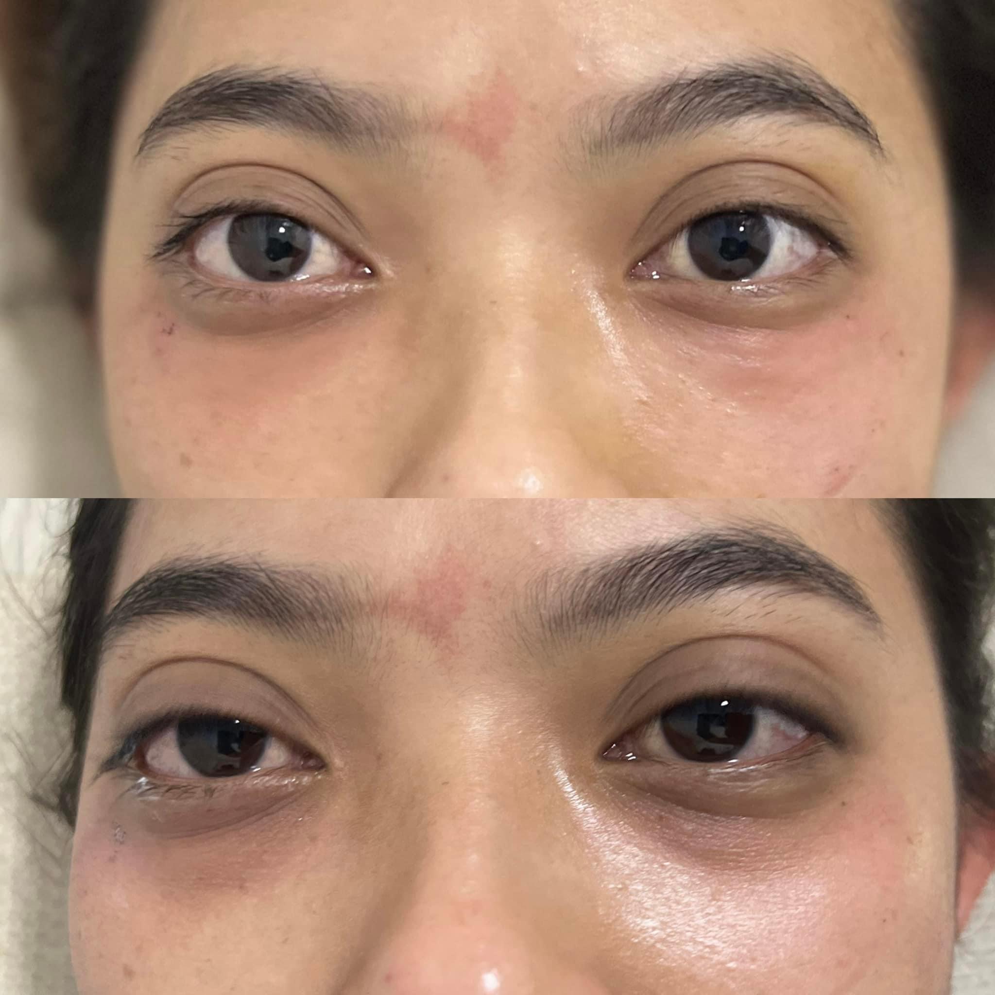 Botox Treatment image 30 at DIVA Skin Clinic Poipet