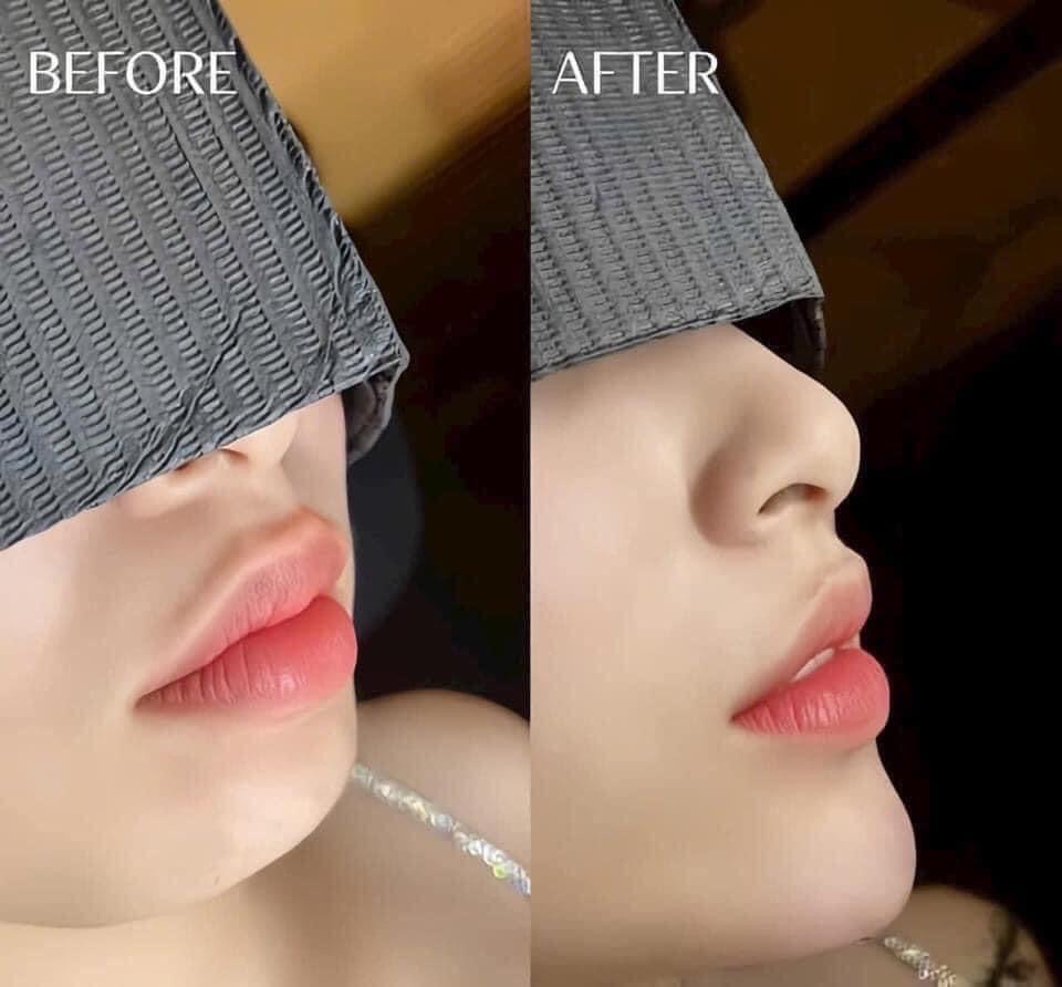 Eye Treatment / Dark Circles