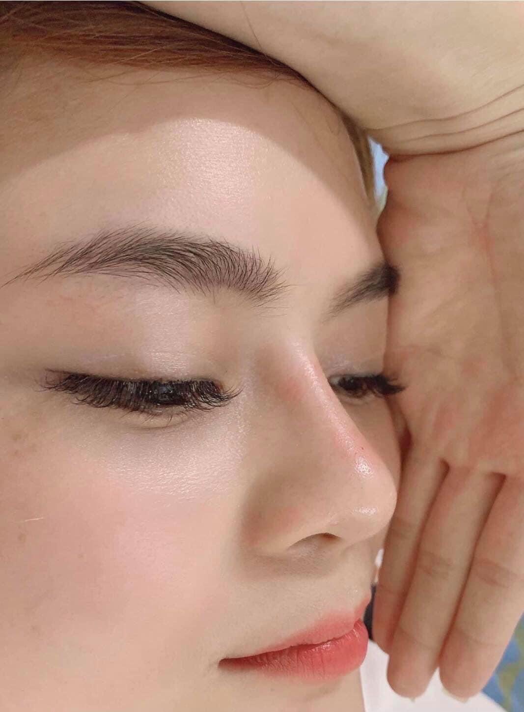 Dermal Filler image 7 at DIVA Skin Clinic Poipet