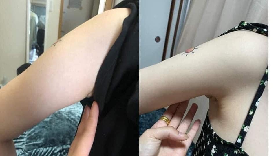 Fat Dissolving Body Contouring image 7 at DIVA Skin Clinic Poipet