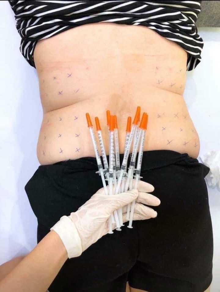 Arms at DIVA Skin Clinic Poipet