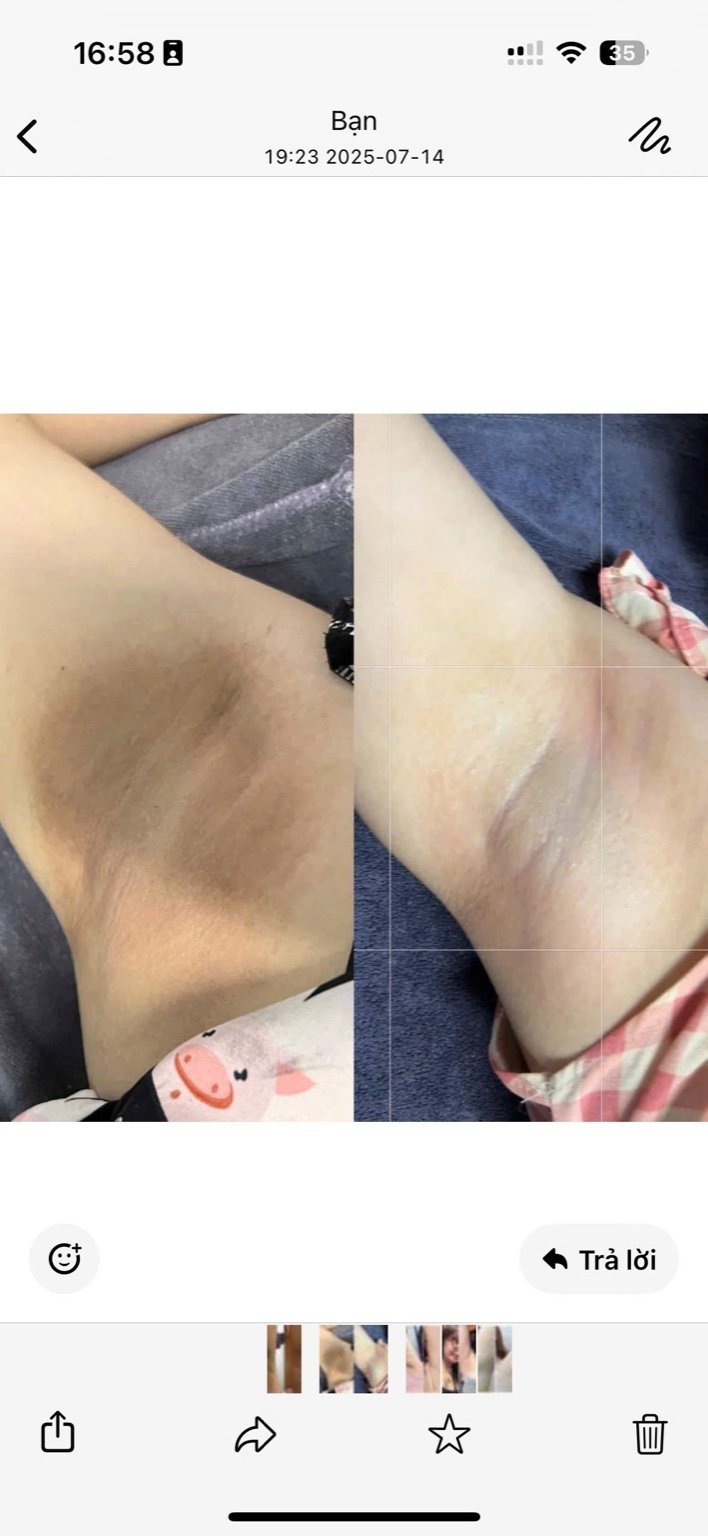 Fat Dissolving Body Contouring image 4 at DIVA Skin Clinic Poipet