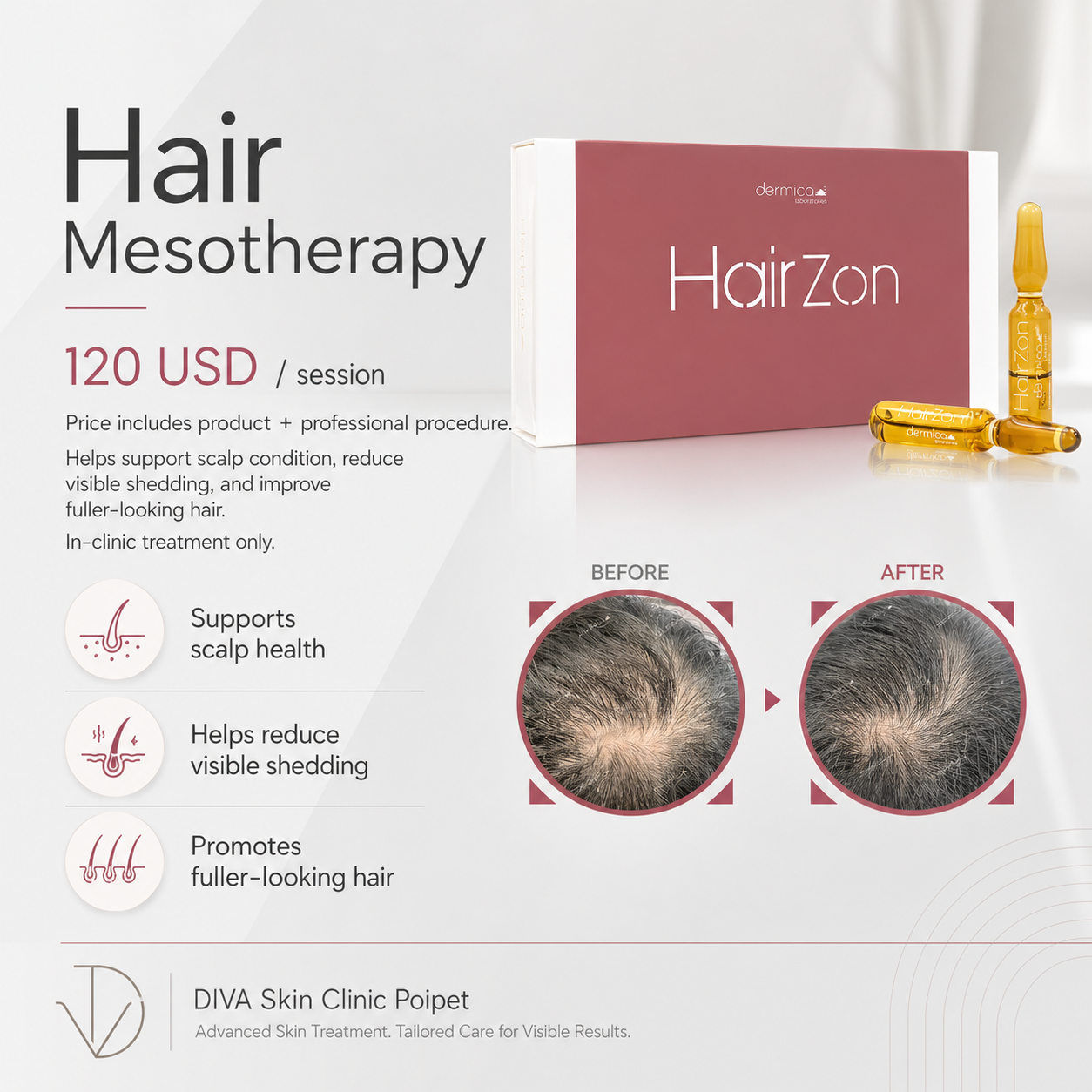 Hair Mesotherapy image 23 at DIVA Skin Clinic Poipet