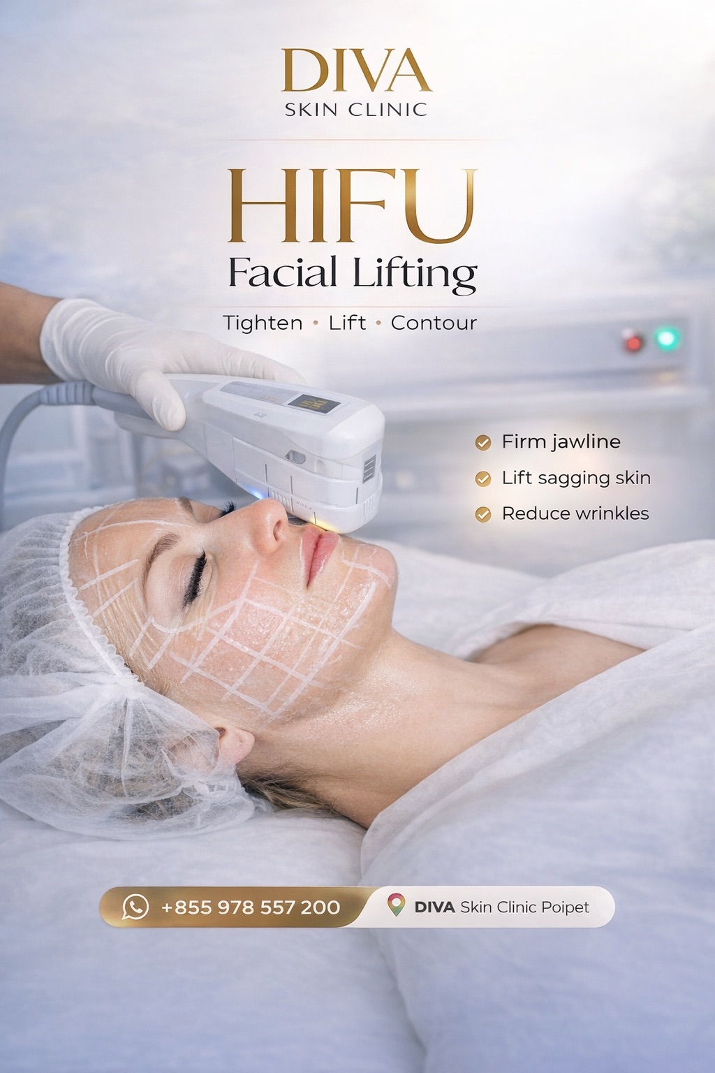 Prolonged Numbness After HIFU: When Is Assessment Needed?