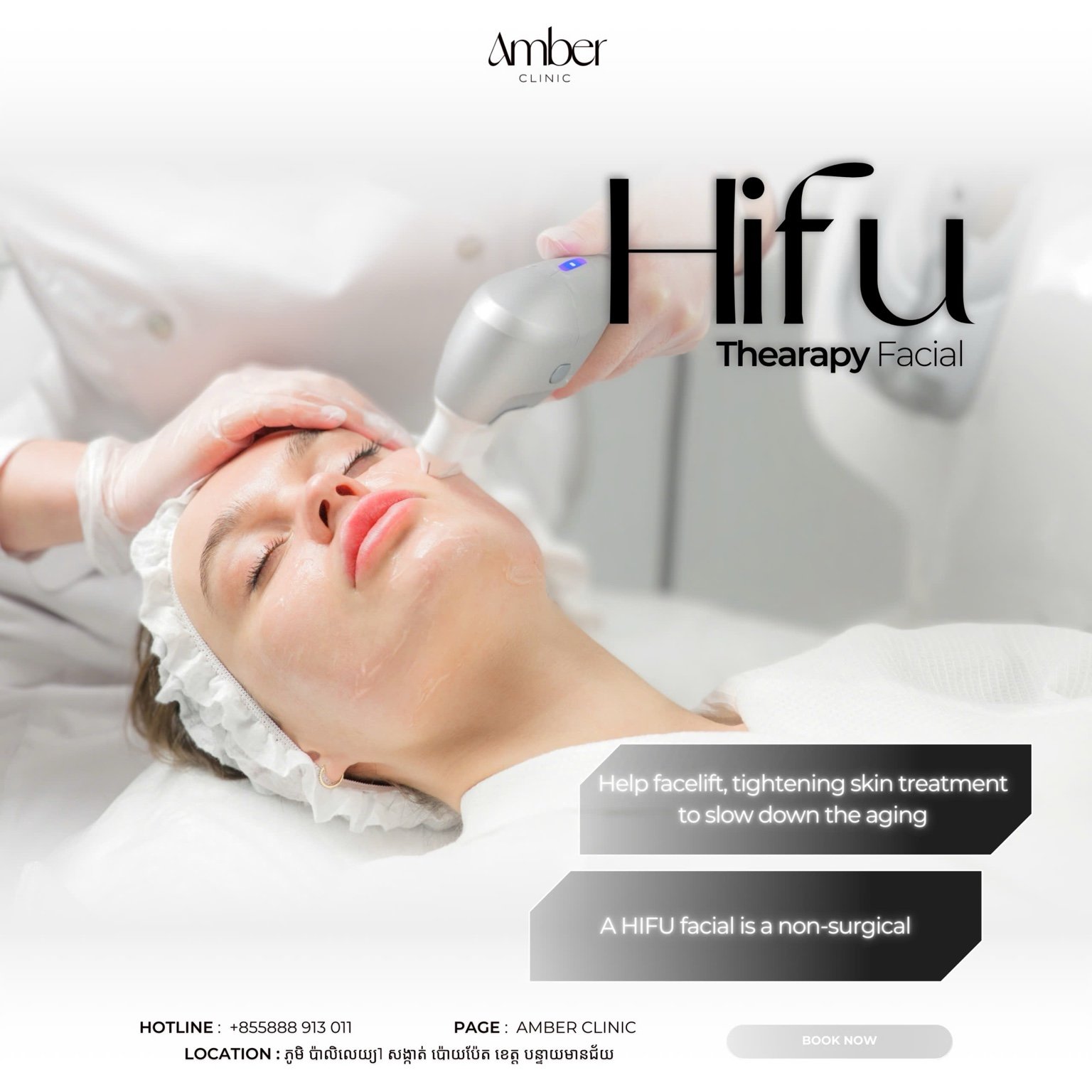 HIFU Facelift in Poipet — image 7