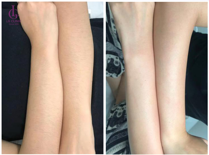 Sensitive Skin and Skin Barrier Repair in Poipet