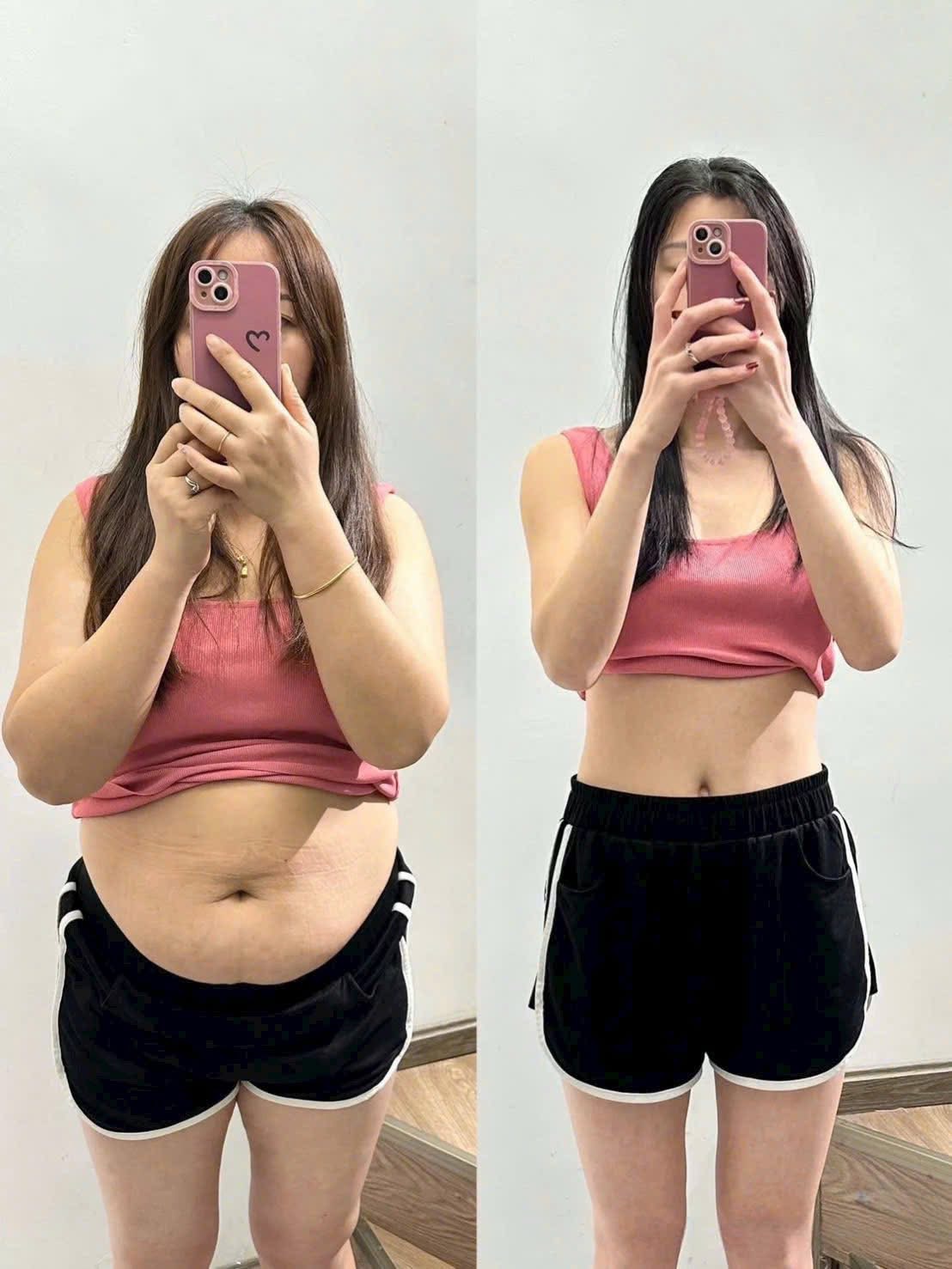 Mounjaro and Medical Weight Management Guide in Poipet