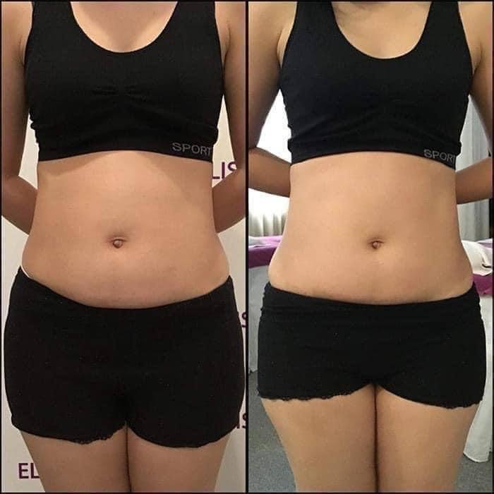 Mounjaro Weight Management image 27 at DIVA Skin Clinic Poipet