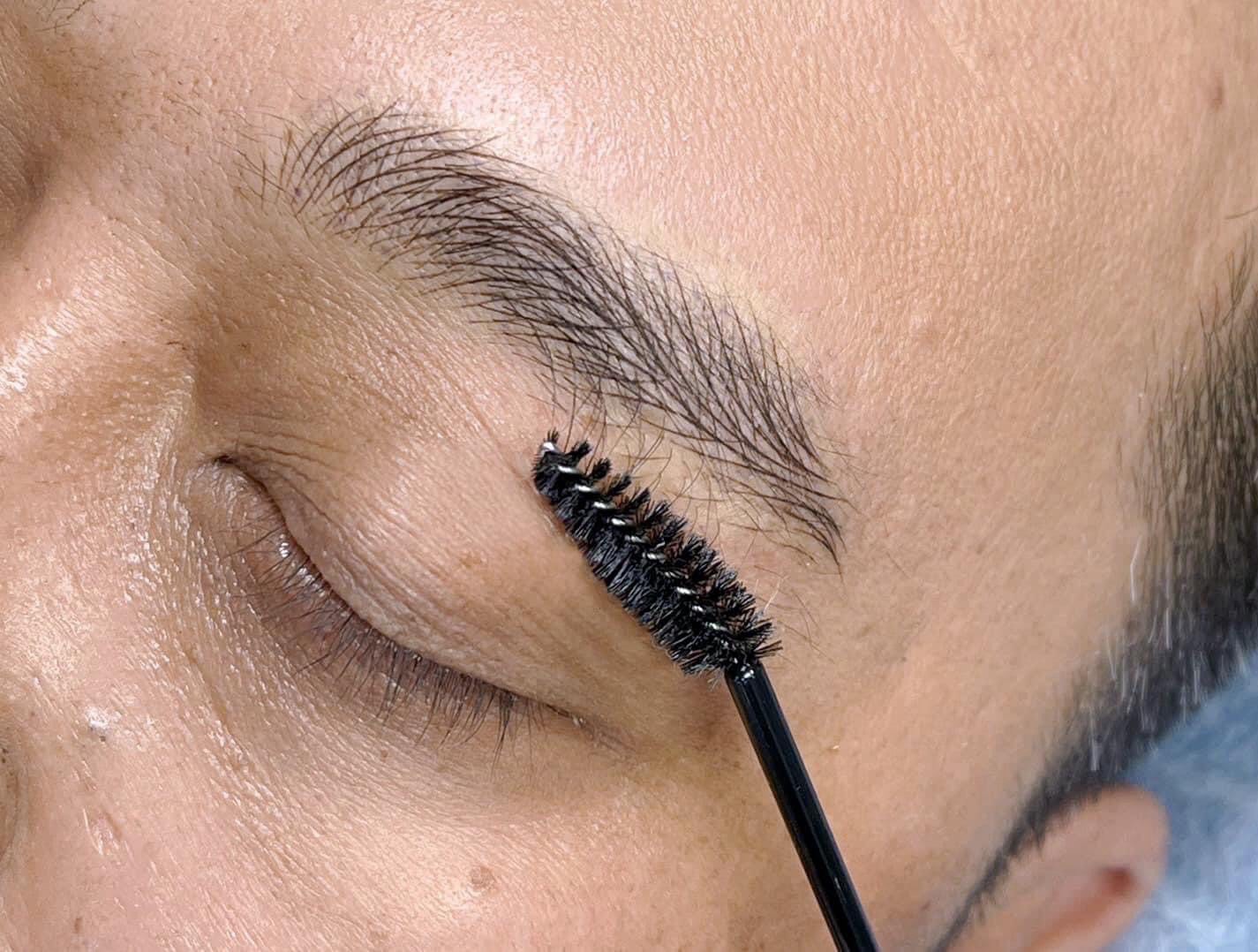 Permanent Makeup and Tattoo Removal image 5 at DIVA Skin Clinic Poipet