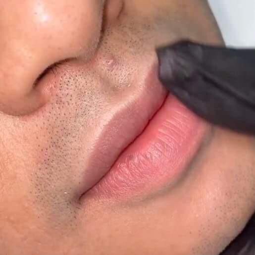 Permanent Makeup and Tattoo Removal image 6 at DIVA Skin Clinic Poipet