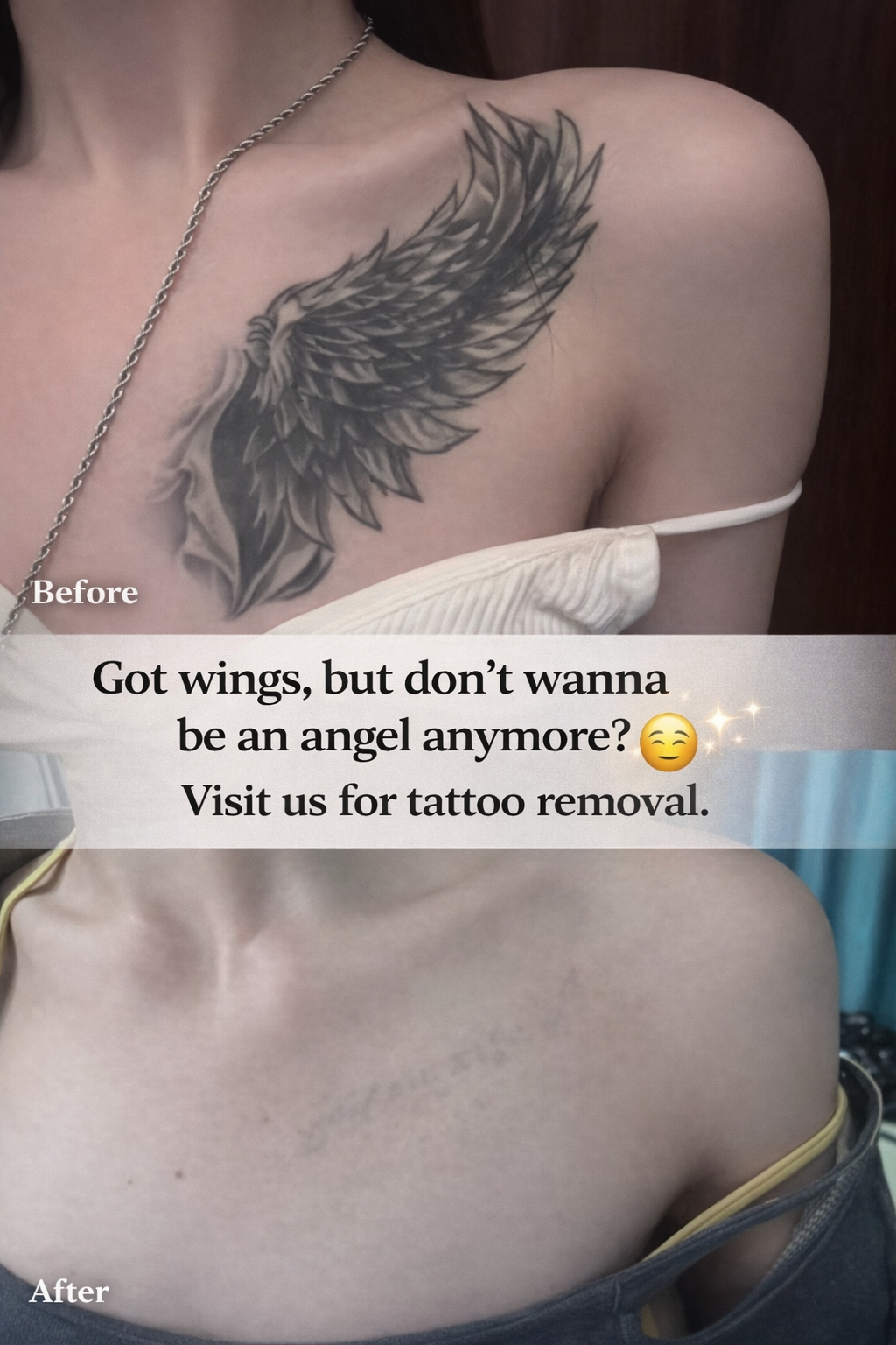 Permanent Makeup & Tattoo Removal
