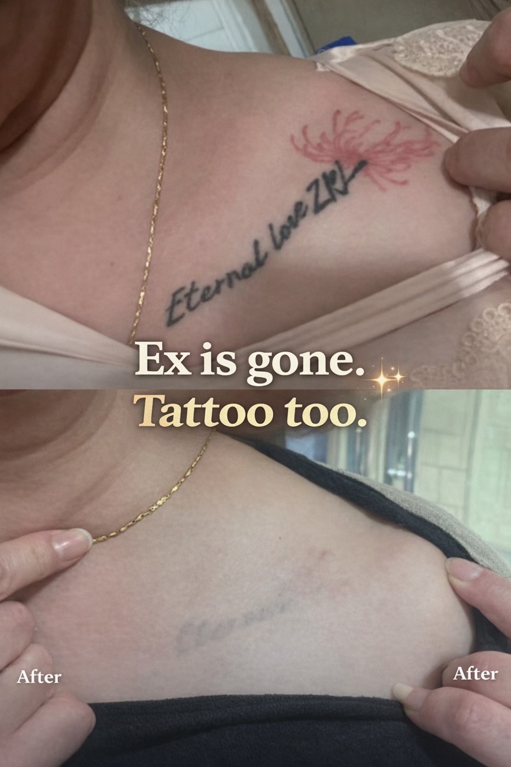 Permanent Makeup and Tattoo Removal image 12 at DIVA Skin Clinic Poipet