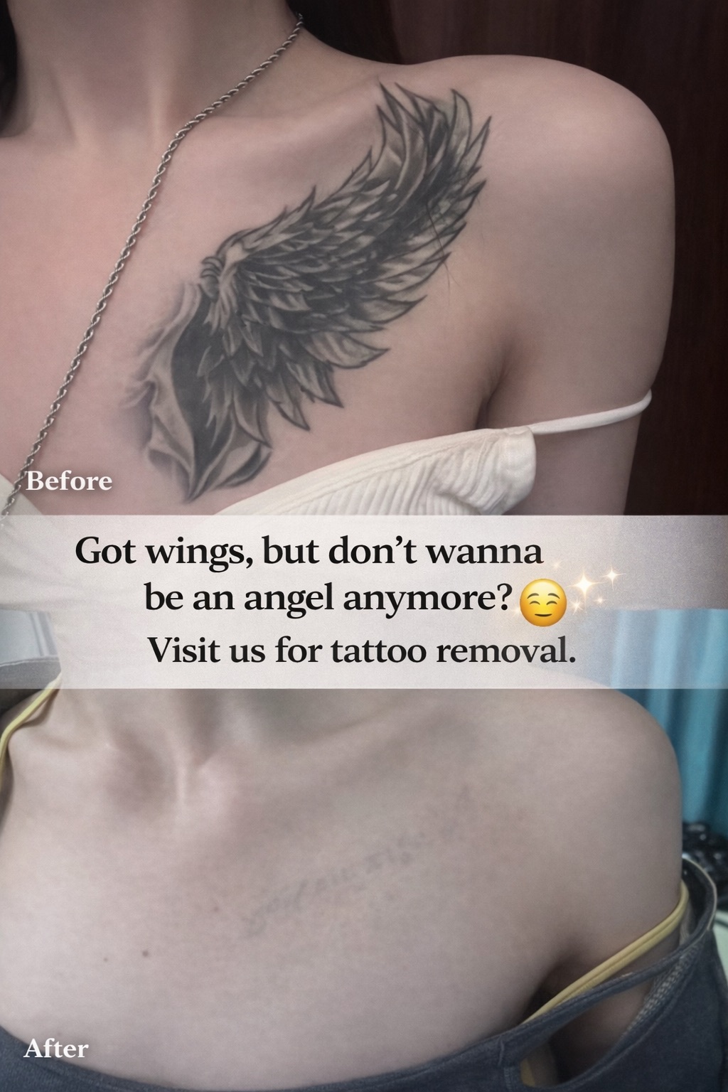 Permanent Makeup and Tattoo Removal image 15 at DIVA Skin Clinic Poipet