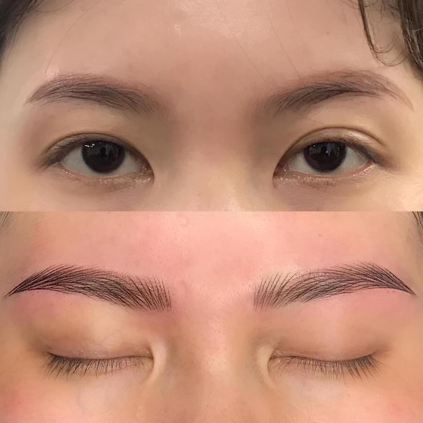 Permanent Makeup and Tattoo Removal image 18 at DIVA Skin Clinic Poipet