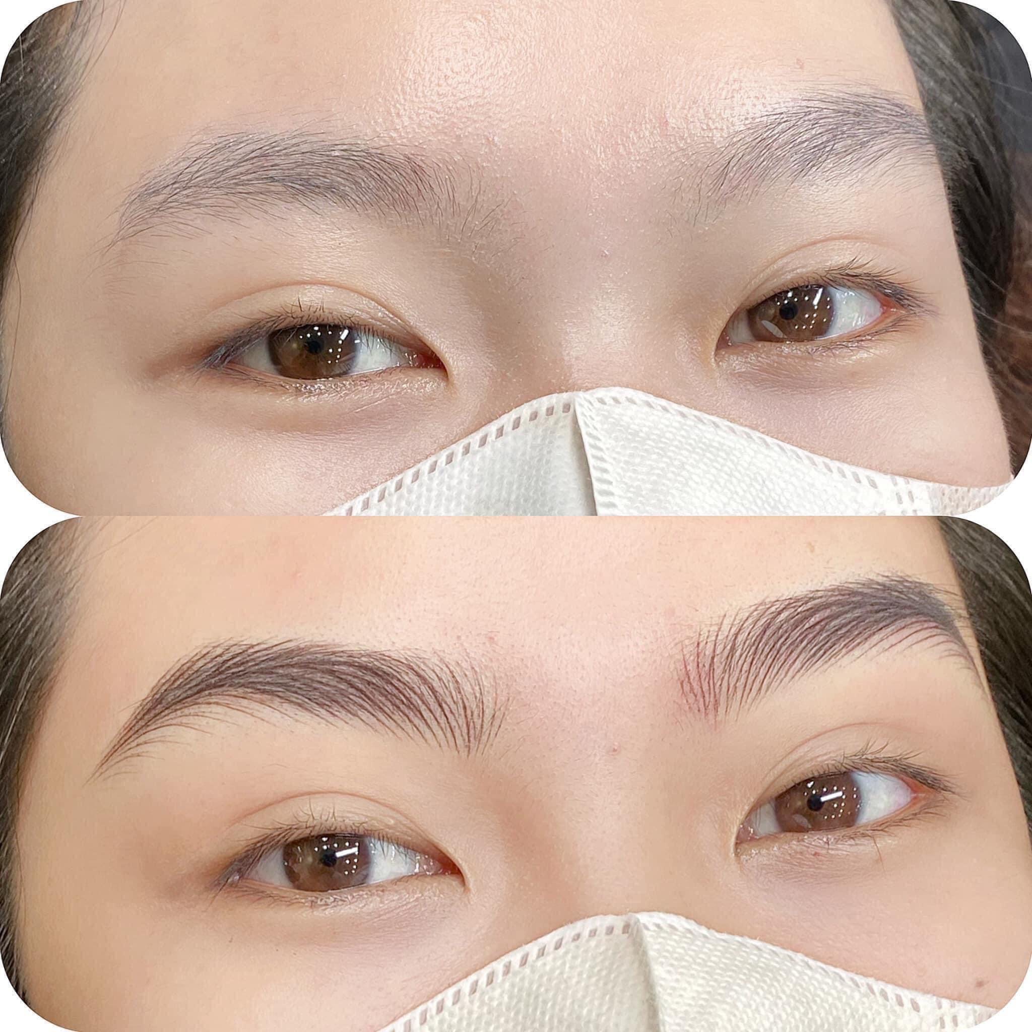 Permanent Makeup and Tattoo Removal image 19 at DIVA Skin Clinic Poipet