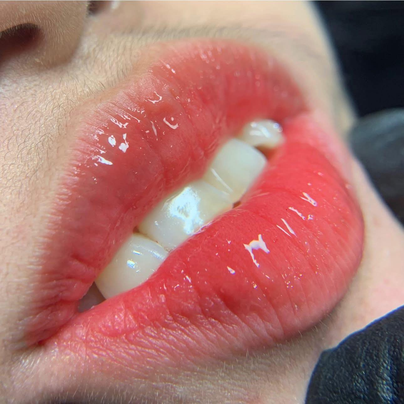 Permanent Makeup and Tattoo Removal image 27 at DIVA Skin Clinic Poipet