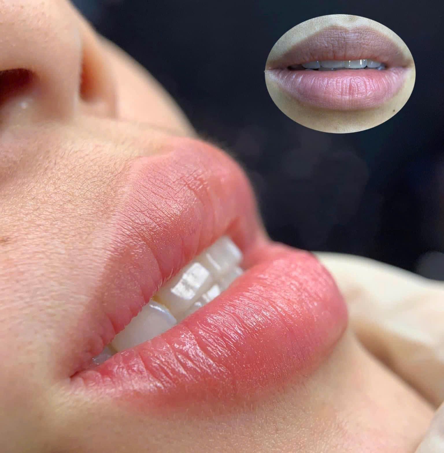 PERMANENT MAKEUP & TATTOO REMOVAL at DIVA Skin Clinic Poipet