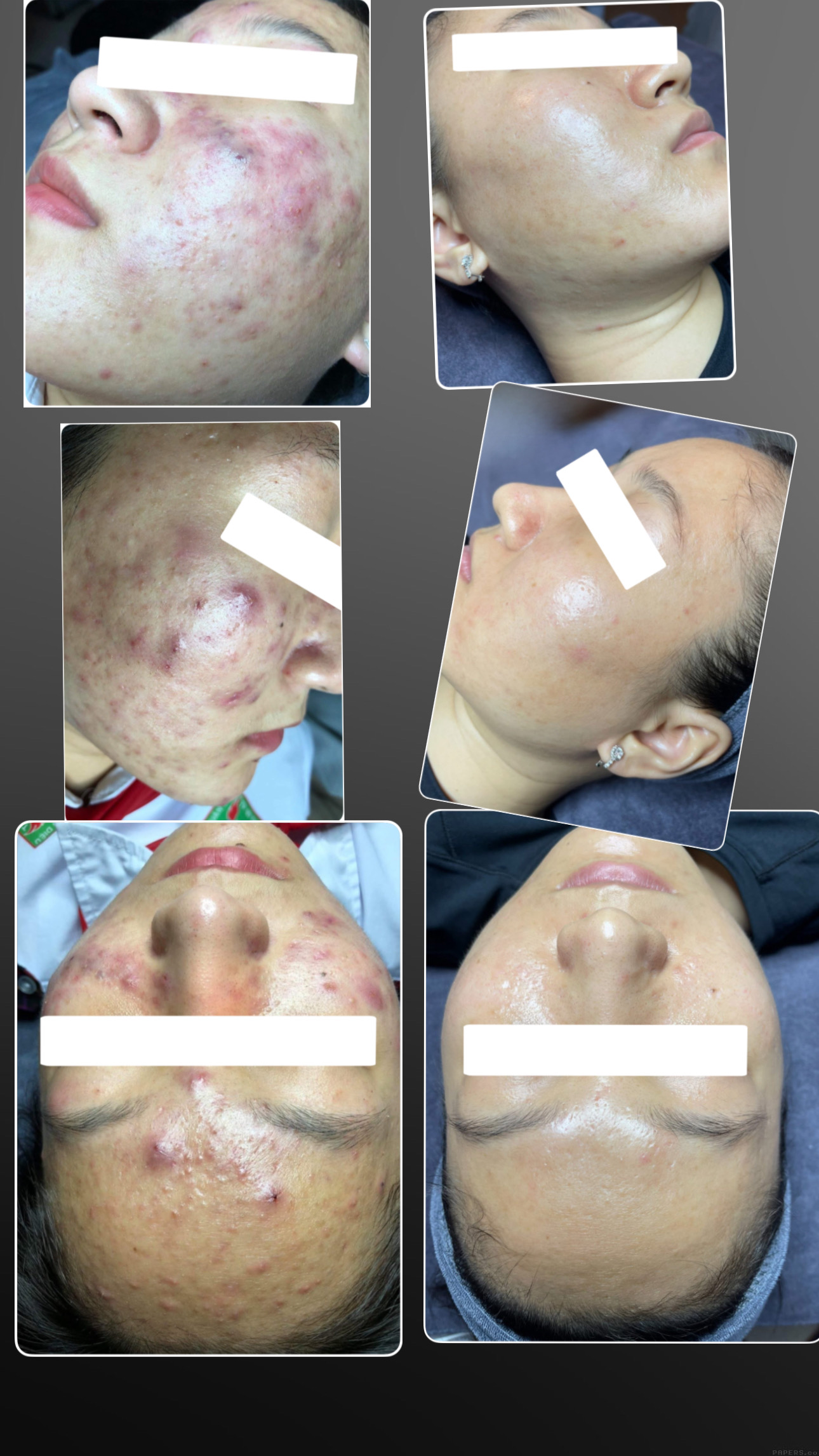 Skin Treatment image 10 at DIVA Skin Clinic Poipet