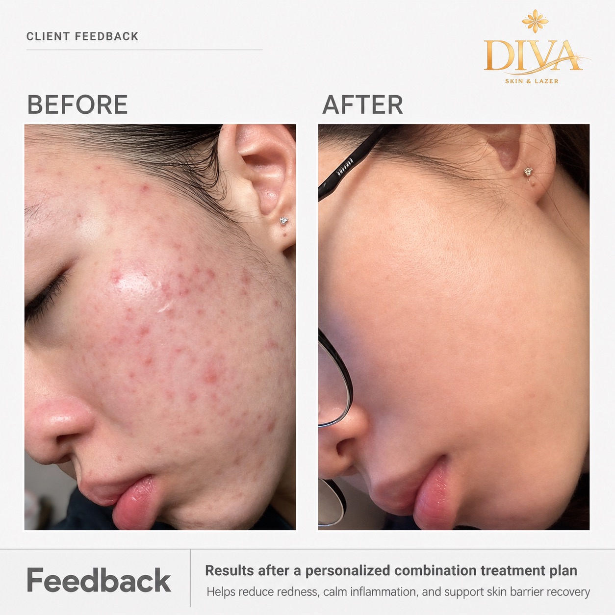 Why Skin Treatment Is Not Like Choosing From a Menu