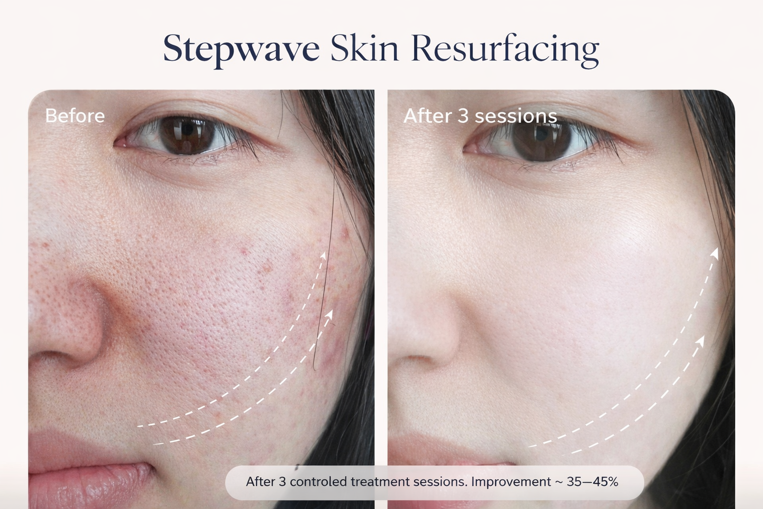 Skin Treatment image 26 at DIVA Skin Clinic Poipet