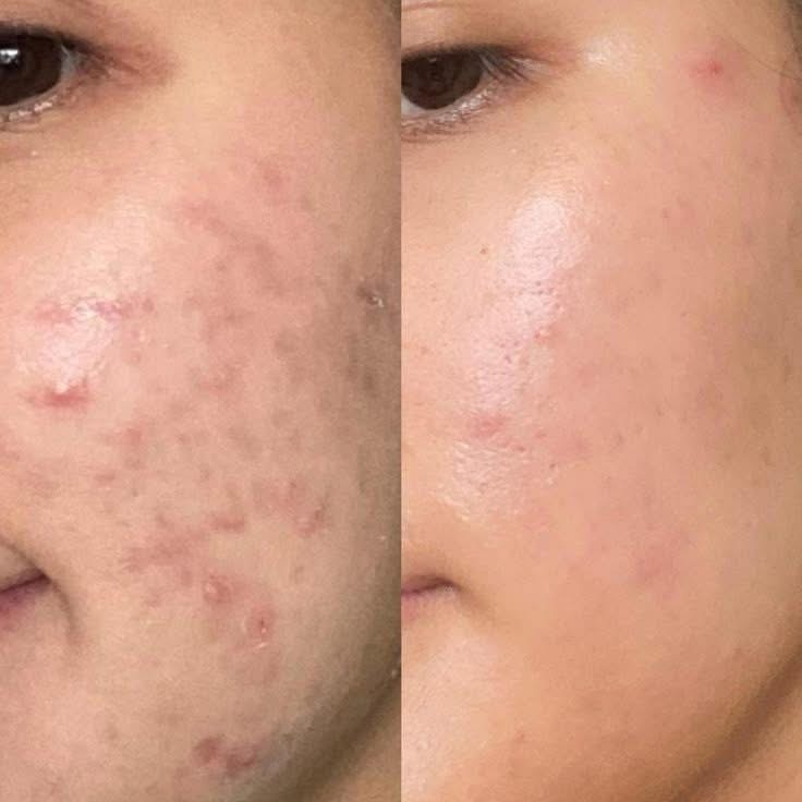 Skin Treatment image 31 at DIVA Skin Clinic Poipet