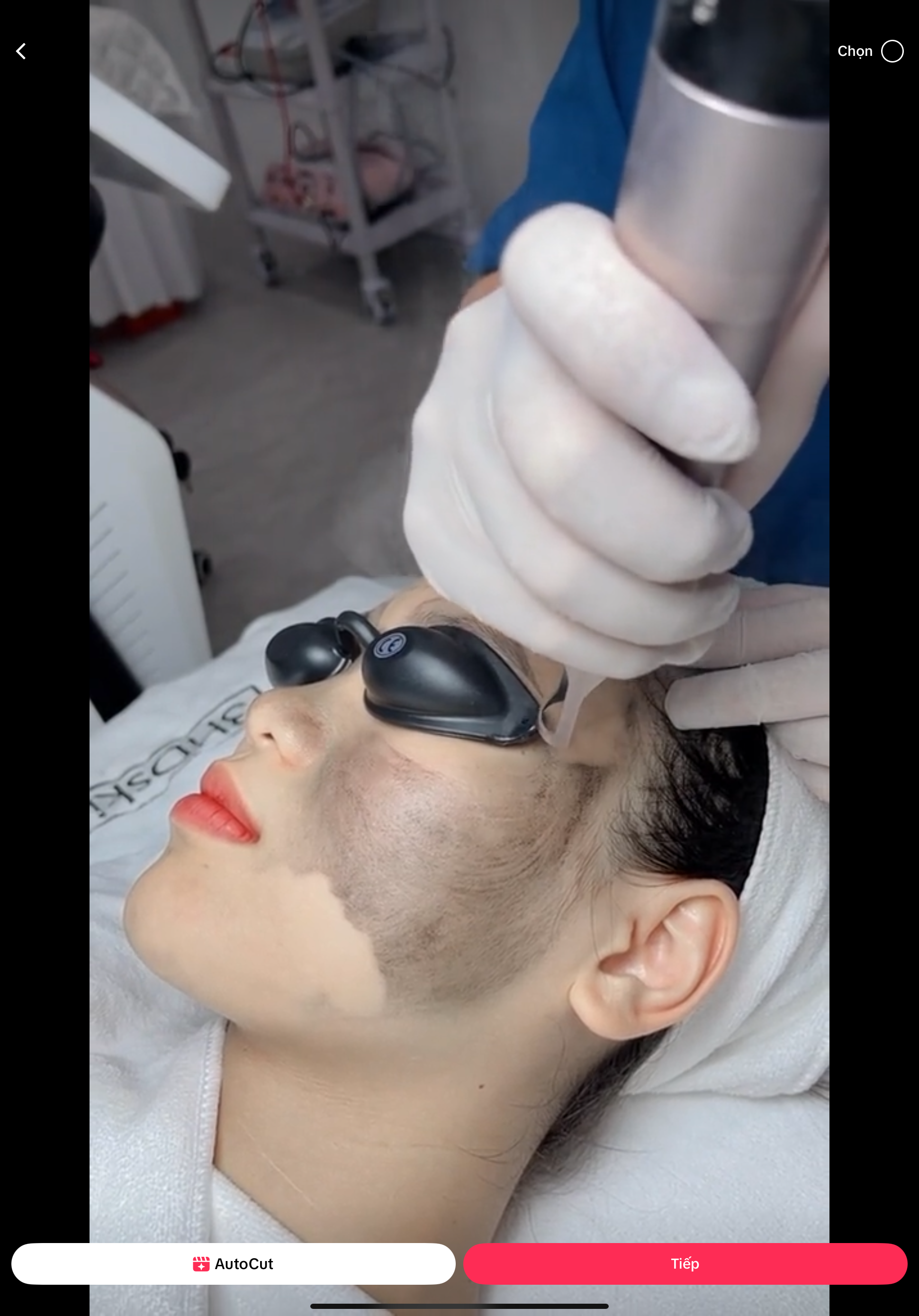 Rough Skin and Uneven Texture