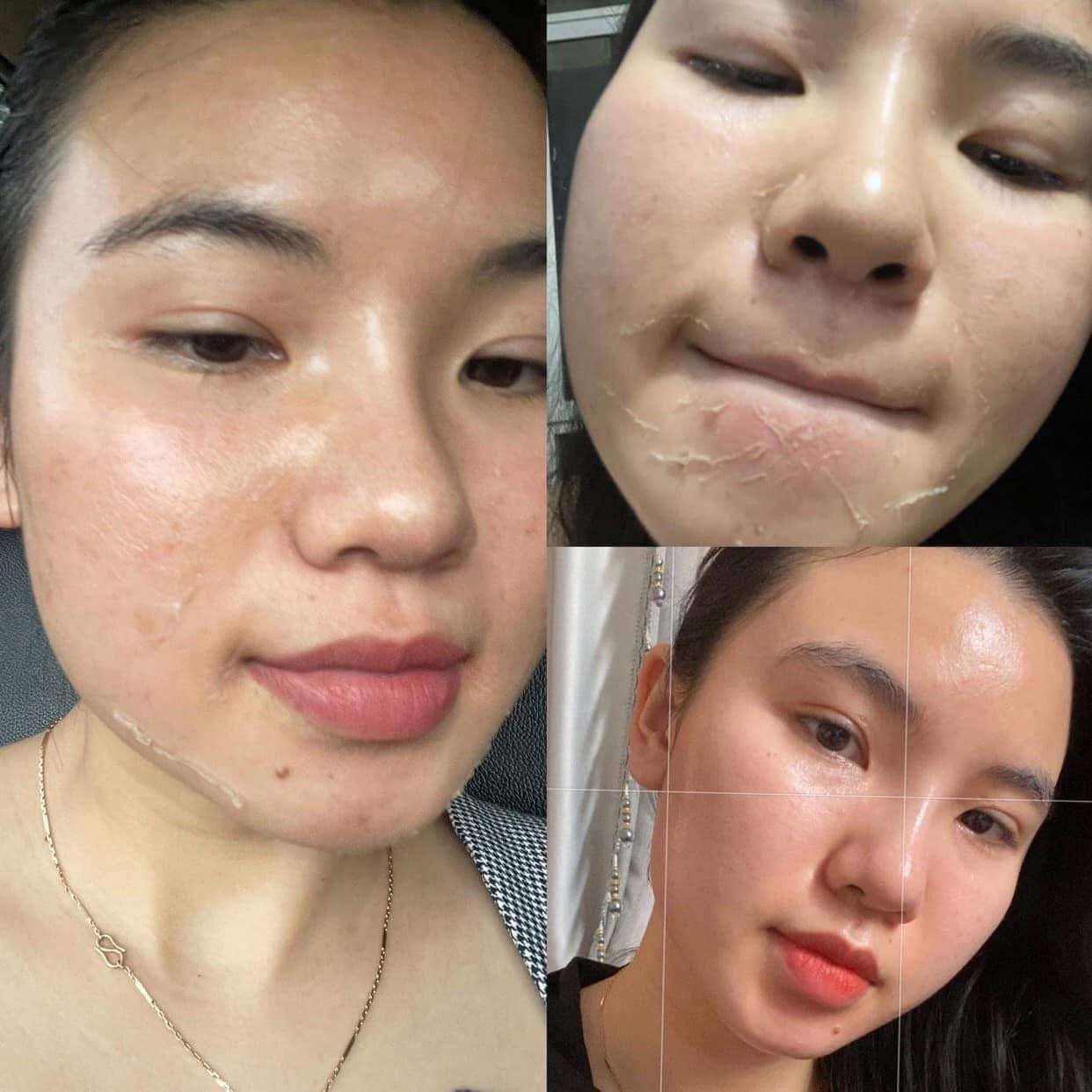 Skin Treatment image 42 at DIVA Skin Clinic Poipet