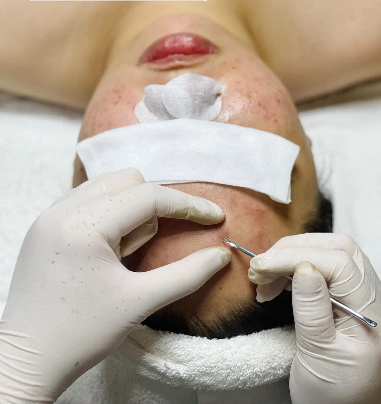 Skin Treatment image 52 at DIVA Skin Clinic Poipet
