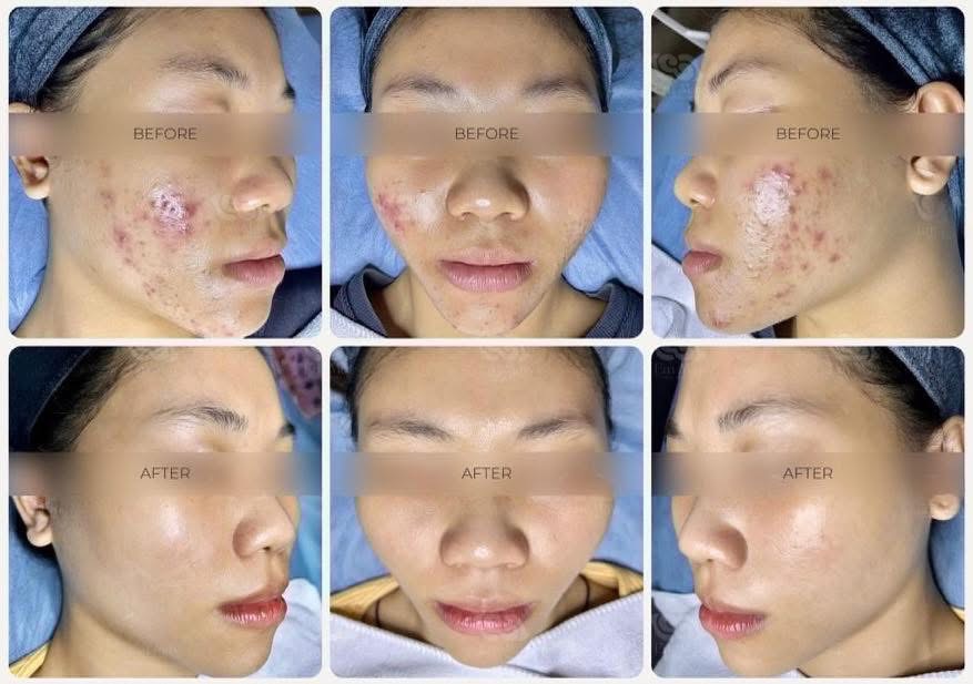 Why Many People Do Not Want to Buy a Treatment Package