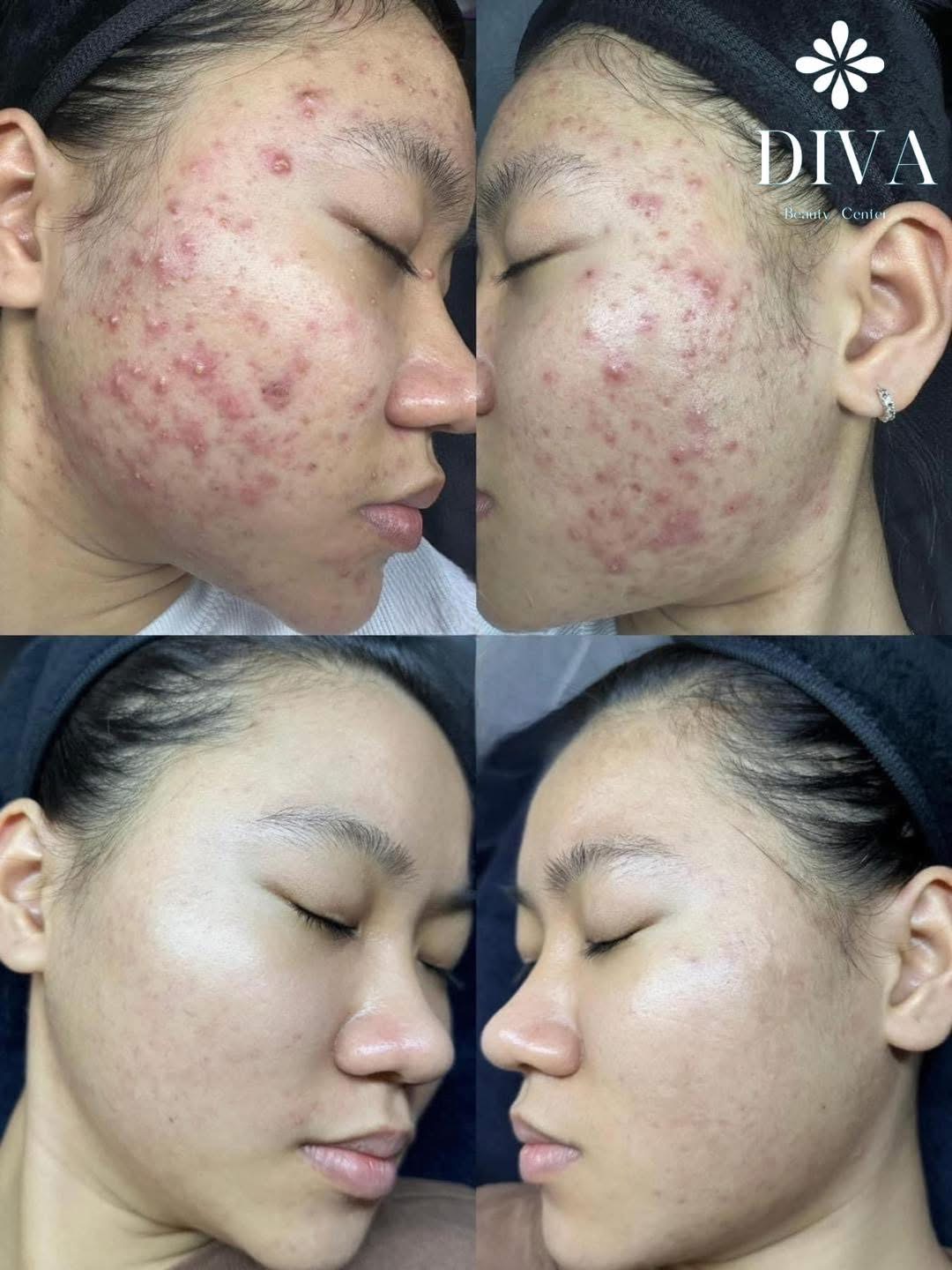 Beauty and Skin Treatment Clinic for Indonesian Clients in Poipet, Cambodia