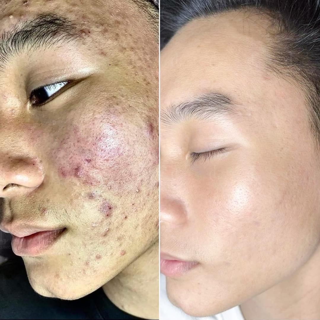 Skin Treatment in Poipet — image 6
