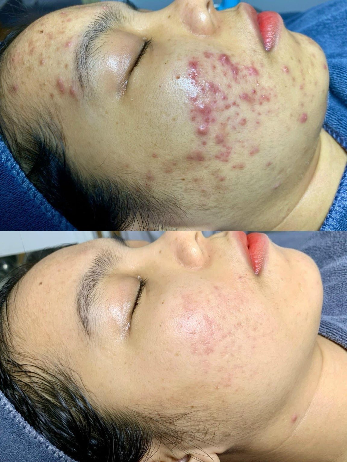 Skin Treatment in Poipet — image 7